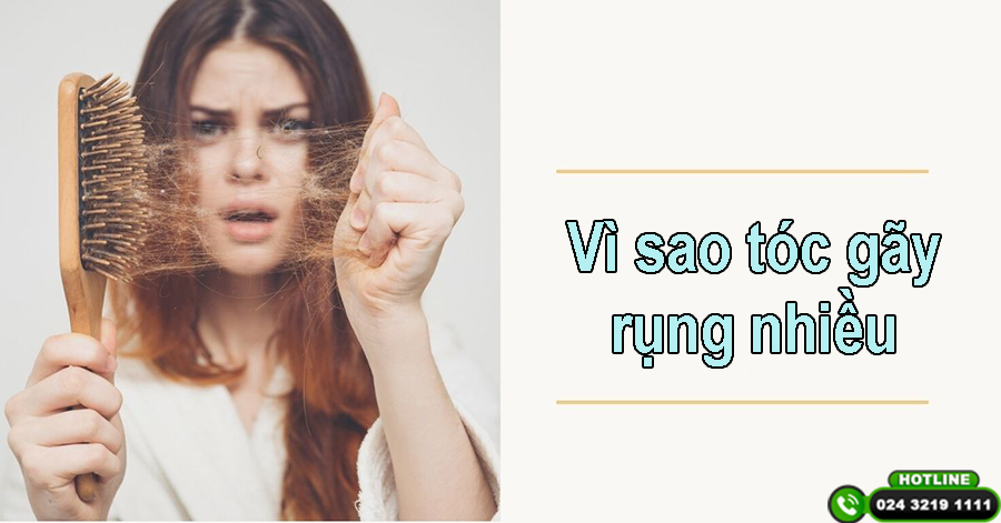 Vì sao tóc gãy rụng nhiều? 9 nguyên nhân thường gặp