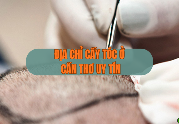 Cấy tóc ở Cần Thơ: Địa chỉ uy tín giúp lấy lại mái tóc dày tự nhiên
