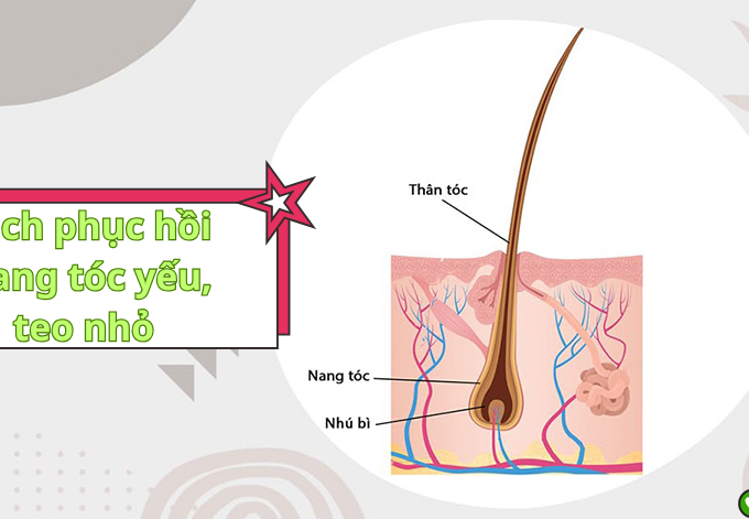 Bí quyết phục hồi nang tóc yếu, teo nhỏ hiệu quả
