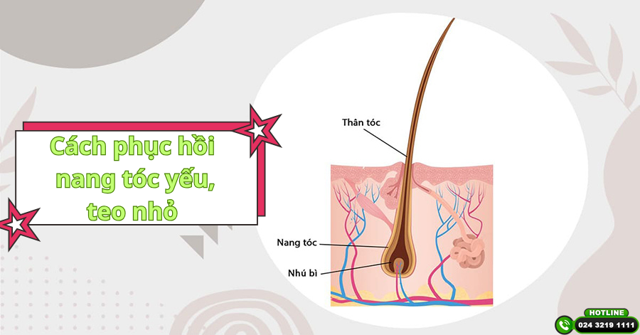 Bí quyết phục hồi nang tóc yếu, teo nhỏ hiệu quả