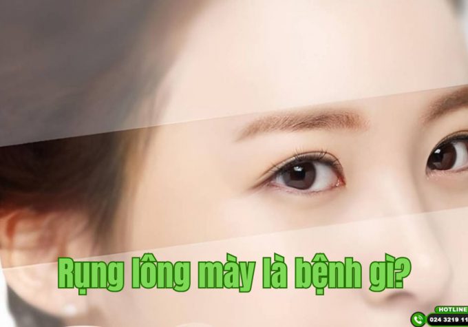 Rụng lông mày là bệnh gì? Làm thế nào để lông mày mọc lại