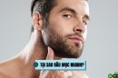 Tại sao râu mọc nhanh? Những yếu tố ảnh hưởng tới tốc độ mọc râu