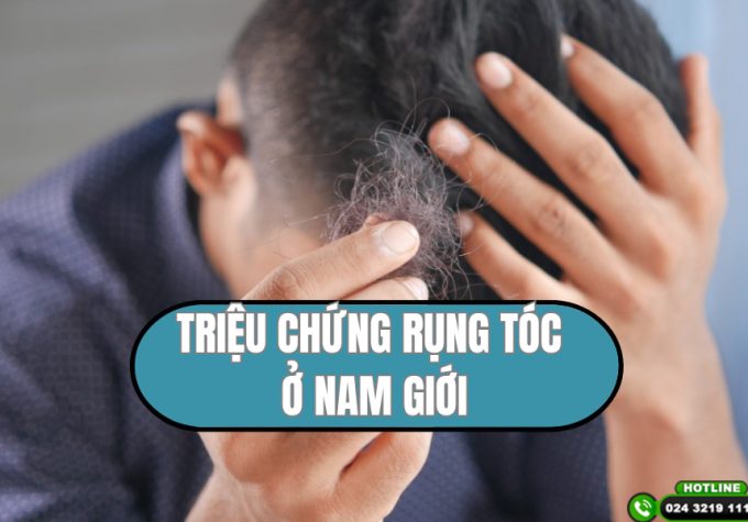 Triệu chứng rụng tóc ở nam giới và cách khắc phục hiệu quả