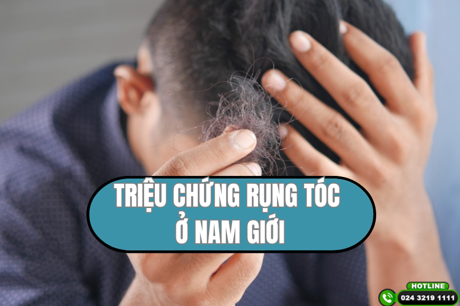 Triệu chứng rụng tóc ở nam giới và cách khắc phục hiệu quả