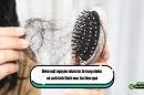 Điểm mặt nguyên nhân tóc bị rụng nhiều và cách kích thích mọc tóc hiệu quả