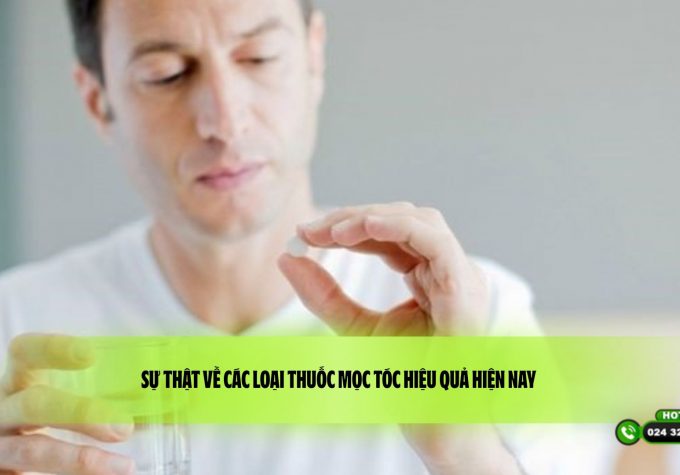 Sự thật về các loại thuốc mọc tóc hiệu quả hiện nay 