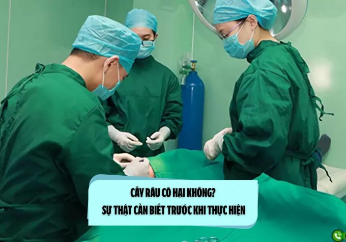 Cấy râu có hại không? Sự thật cần biết trước khi thực hiện
