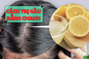 Top 5 cách trị gàu bằng chanh dễ làm tại nhà