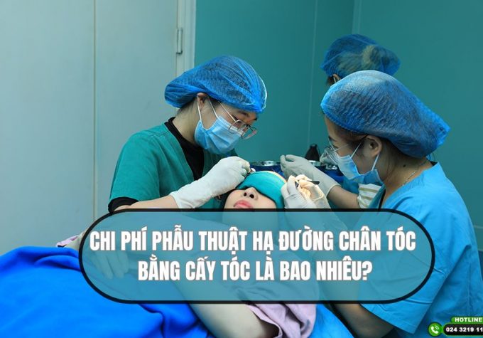 Chi phí phẫu thuật hạ đường chân tóc là bao nhiêu?