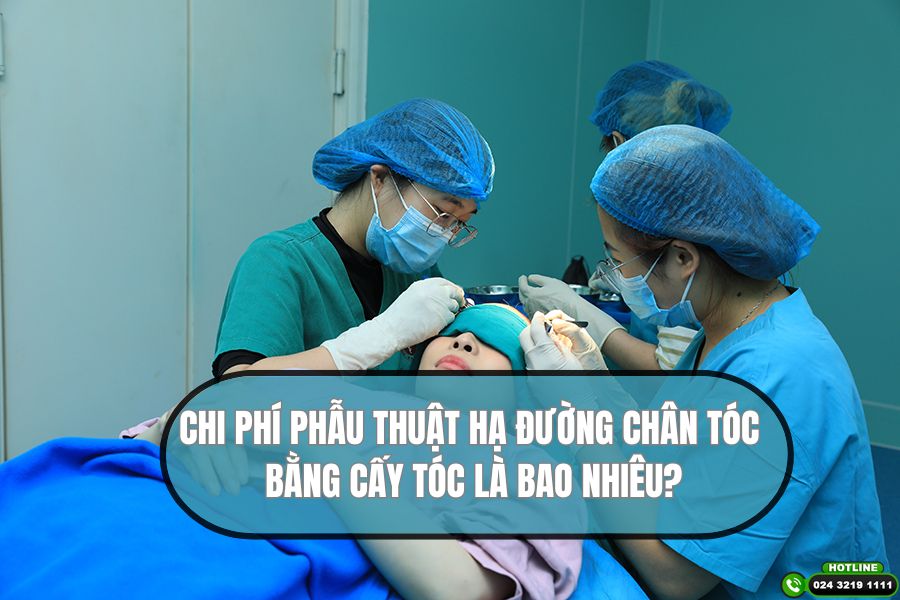 Chi phí phẫu thuật hạ đường chân tóc là bao nhiêu?
