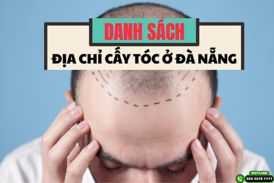 Danh sách phòng khám cấy tóc ở Đà Nẵng uy tín, hiệu quả