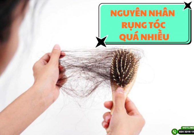 Các nguyên nhân rụng tóc nhiều bạn không nên chủ quan