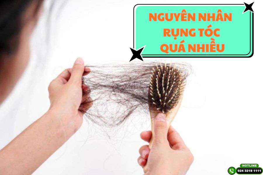 Các nguyên nhân rụng tóc nhiều bạn không nên chủ quan