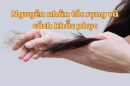 Nguyên nhân tóc rụng và cách khắc phục hiệu quả mà bạn không nên bỏ qua