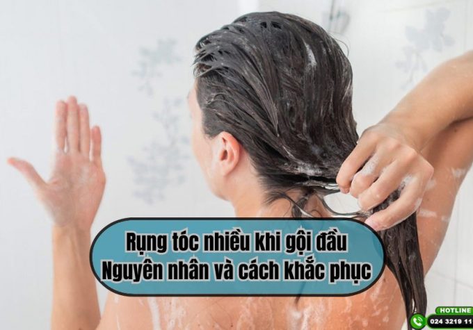 Rụng tóc sau khi gội đầu: 5 nguyên nhân phổ biến có thể bạn chưa biết