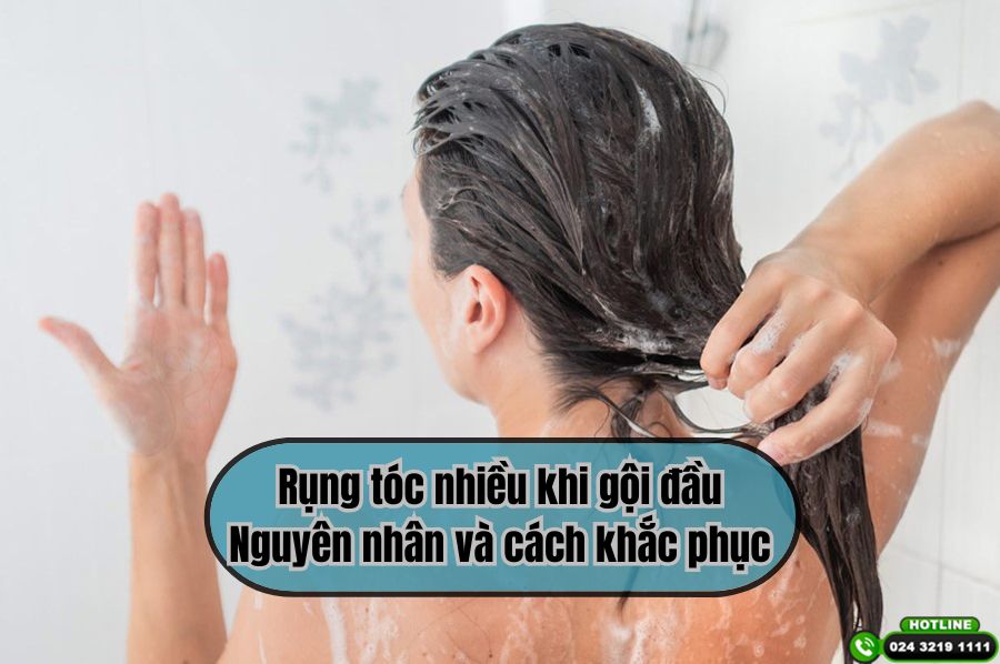 Rụng tóc sau khi gội đầu: 5 nguyên nhân phổ biến có thể bạn chưa biết