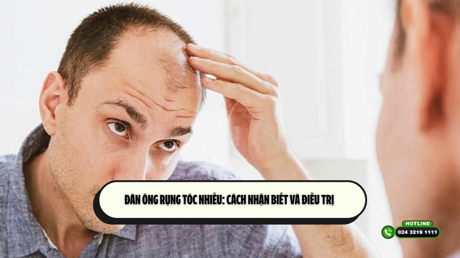 Đàn ông rụng tóc nhiều: cách nhận biết và điều trị 