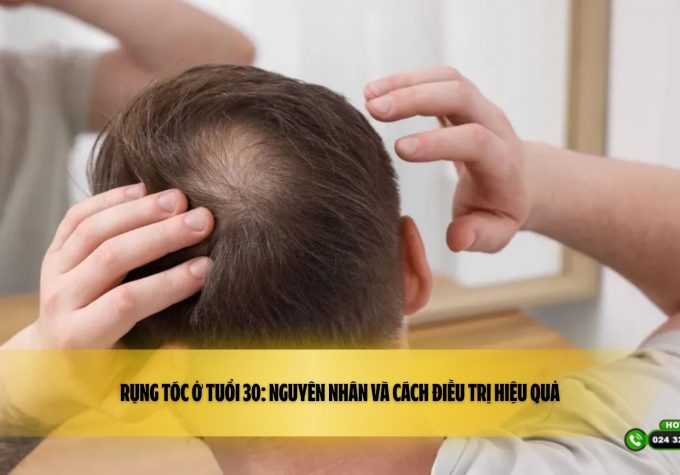 Rụng tóc ở tuổi 30: Nguyên nhân và cách điều trị hiệu quả