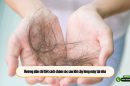 Chuyên gia giải đáp: Tóc rụng sau bao lâu mọc lại?