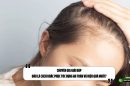 Chuyên gia giải đáp: Đâu là cách khắc phục tóc rụng an toàn và hiệu quả nhất?