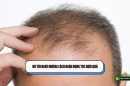 Bỏ túi ngay những cách ngăn rụng tóc hiệu quả