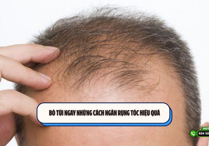 Bỏ túi ngay những cách ngăn rụng tóc hiệu quả