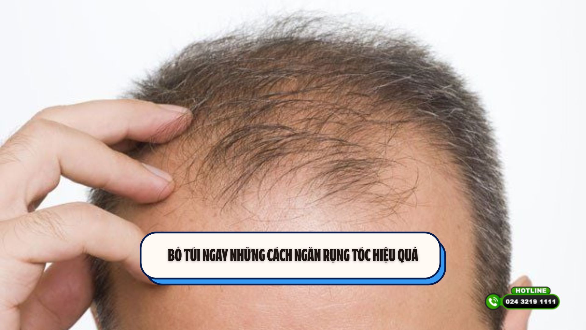Bỏ túi ngay những cách ngăn rụng tóc hiệu quả