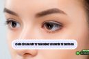 Có nên cấy lông mày tự thân không? Lời khuyên từ chuyên gia