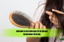 Điểm danh 10 cách chống rụng tóc nữ hiệu quả mà bạn không thể bỏ qua 