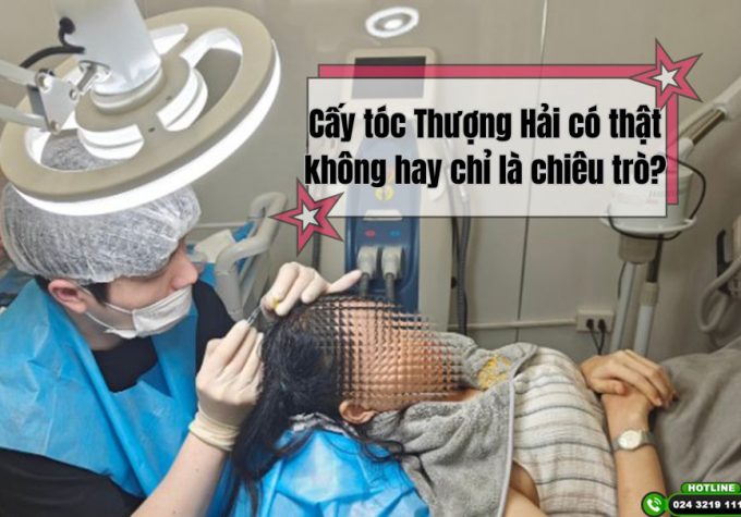 Lật mở câu chuyện: Cấy tóc Thượng Hải có thật không hay chỉ là chiêu trò?