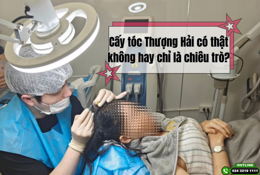 Lật mở câu chuyện: Cấy tóc Thượng Hải có thật không hay chỉ là chiêu trò?