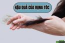 Cảnh báo hậu quả của rụng tóc kéo dài và cách khắc phục hiệu quả