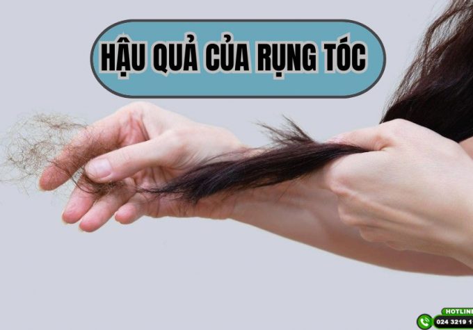 Cảnh báo hậu quả của rụng tóc kéo dài và cách khắc phục hiệu quả