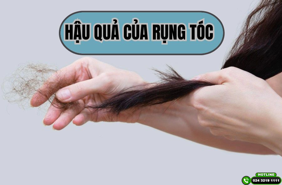 Cảnh báo hậu quả của rụng tóc kéo dài và cách khắc phục hiệu quả