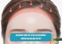 Hạ đường chân tóc có để lại sẹo không?