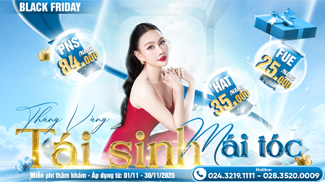 cấy râu tự thân