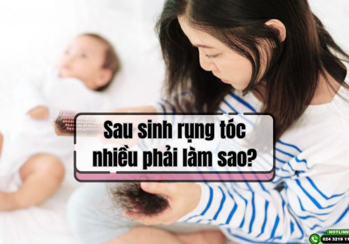 Sinh xong rụng tóc nhiều phải làm sao? Chia sẻ kinh nghiệm chữa rụng tóc sau sinh