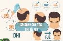Hỏi đáp về cấy tóc: So sánh cấy tóc FUE và DHI để lựa chọn tối ưu