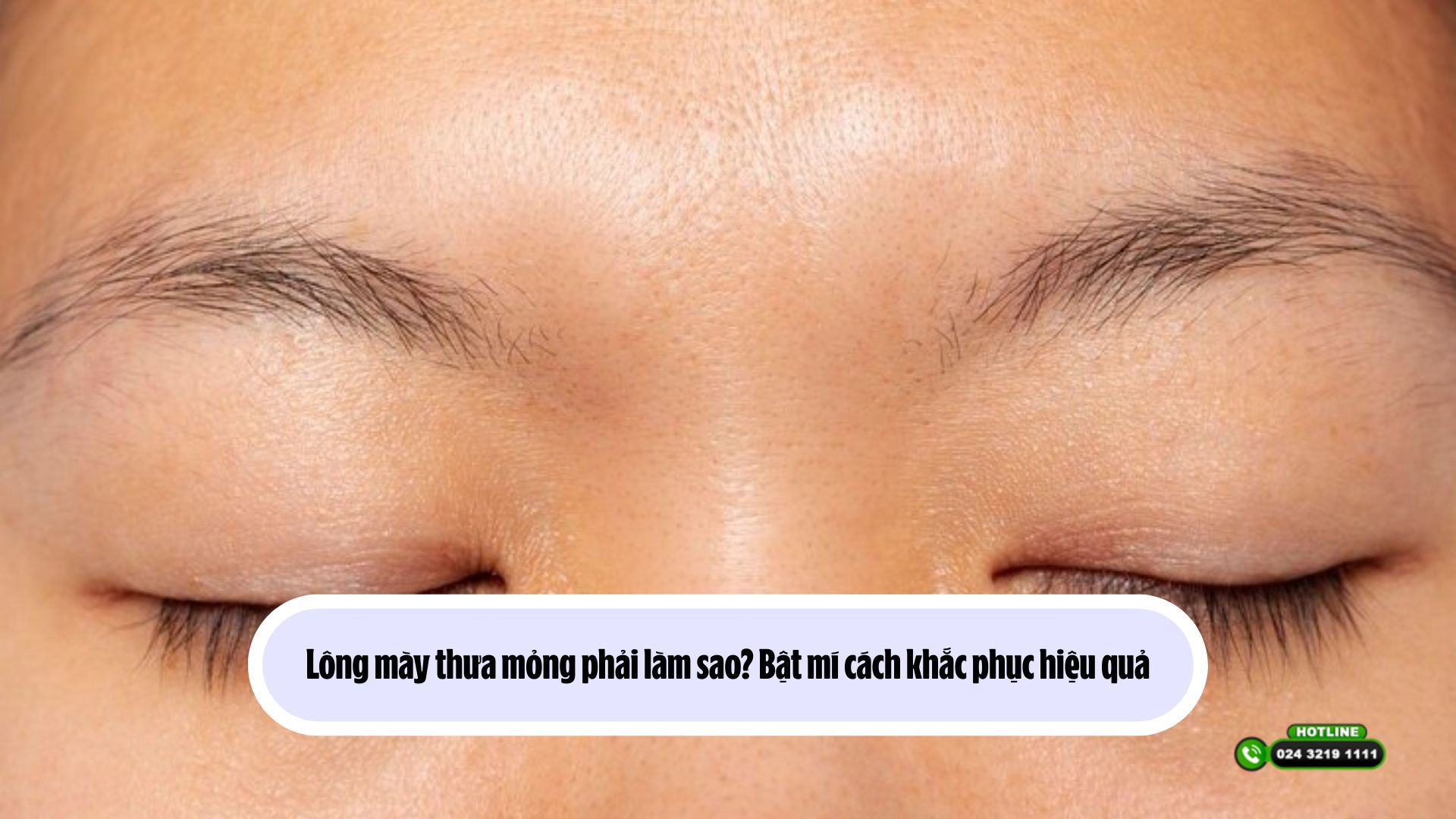Lông mày thưa mỏng phải làm sao? Bật mí cách khắc phục hiệu quả
