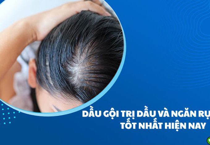 Top 7 Dầu Gội Trị Dầu Và Ngăn Rụng Tóc Tốt Nhất Hiện Nay