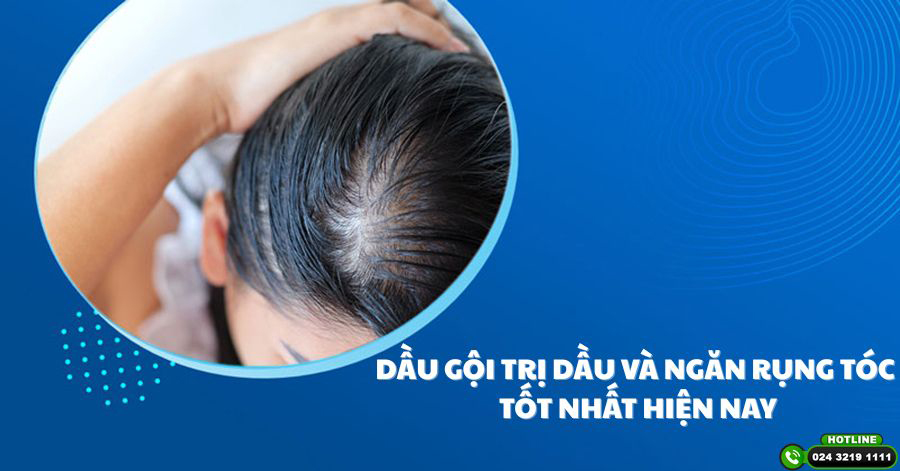 Top 7 Dầu Gội Trị Dầu Và Ngăn Rụng Tóc Tốt Nhất Hiện Nay