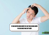 Lý giải nguyên nhân khiến tóc con trai bị rụng nhiều và cách khắc phục dứt điểm