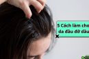 Giải cứu mái tóc bết nhờn với 5 cách làm cho da đầu đỡ dầu cực hiệu quả