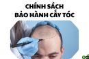Chính sách bảo hành cấy tóc lâu dài tại Viện Cấy tóc Quốc tế – Đầu tư 1 lần, yên tâm cả đời