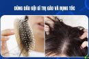 Dùng dầu gội gì trị gàu và rụng tóc hiệu quả – Chuyên gia chia sẻ