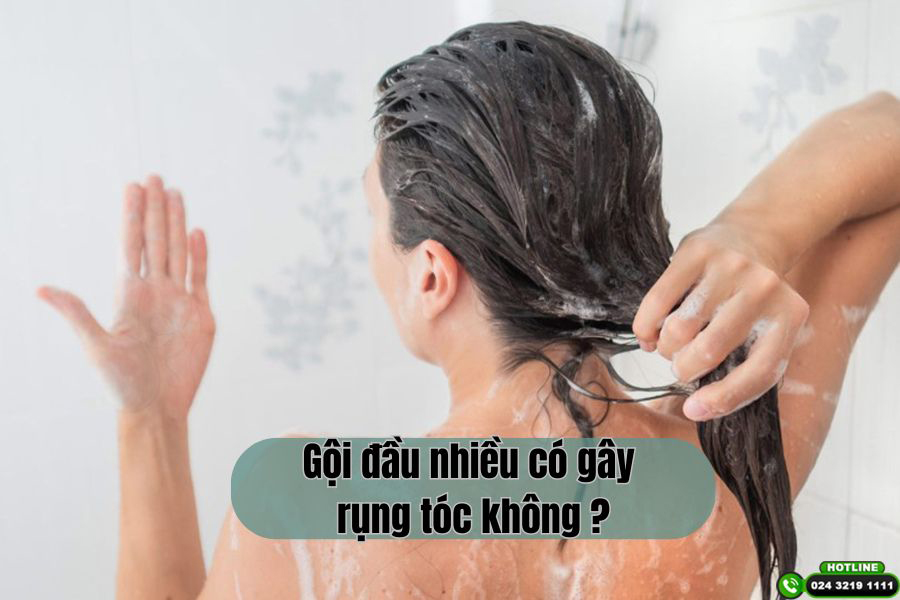 [Góc giải đáp]: Gội đầu thường xuyên có gây rụng tóc?