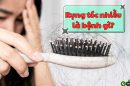 Chuyên gia giải đáp: Rụng tóc nhiều bị bệnh gì?