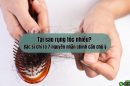 Tại sao rụng tóc nhiều? Bác sĩ chỉ ra 7 nguyên nhân chính cần chú ý