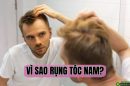 Vì sao rụng tóc nam? 7 Nguyên nhân phổ biến nhất hiện nay