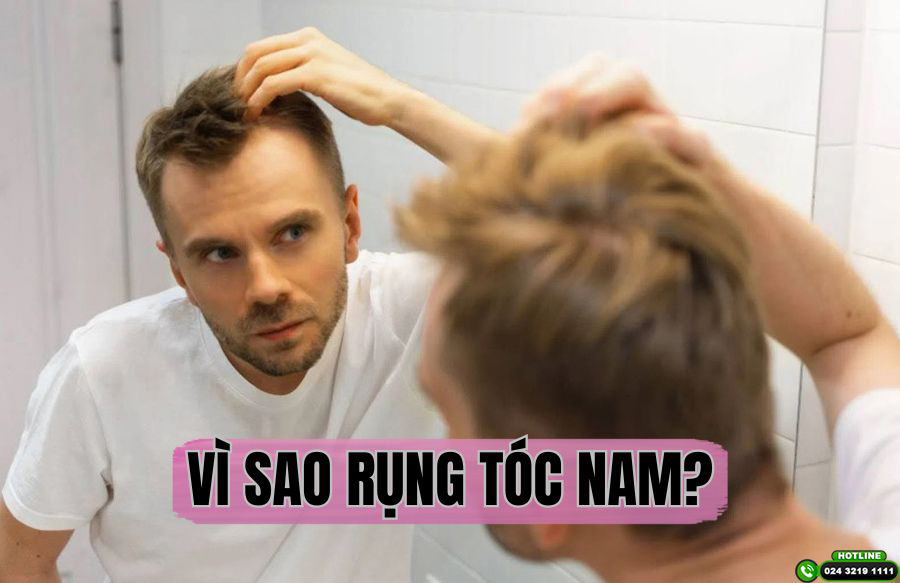 Vì sao rụng tóc nam? 7 Nguyên nhân phổ biến nhất hiện nay
